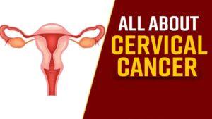 Understanding Cervical Cancer: Types, Symptoms, and Treatment