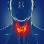 Understanding Thyroid Diseases: Causes, Symptoms, and Treatment Options