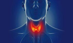 Understanding Thyroid Diseases: Causes, Symptoms, and Treatment Options