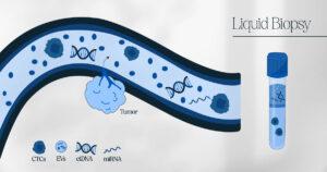Liquid Biopsy: A Lifeline of Hope in the Battle Against Cancer